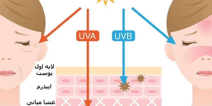 تاثیر UVA , UVB روی پوست