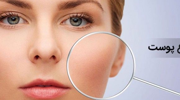 جنس پوست شما چیست؟