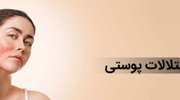  اختلالات پوستی چیست و چگونه ایجاد می شود