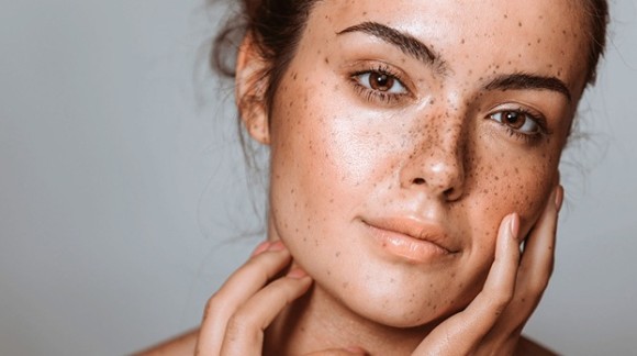 روتین پوستی مناسب پوست های حساس و آتوپیک